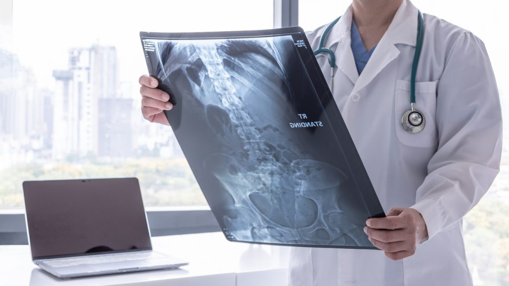 Laudo a distância na radiologia
