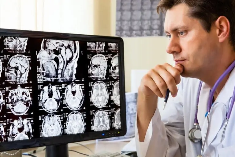 Médico analisando um exame eletroencefalograma (EEG)