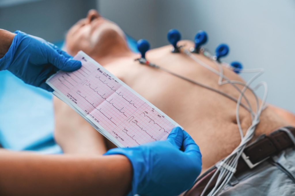 Calibração de ECG
