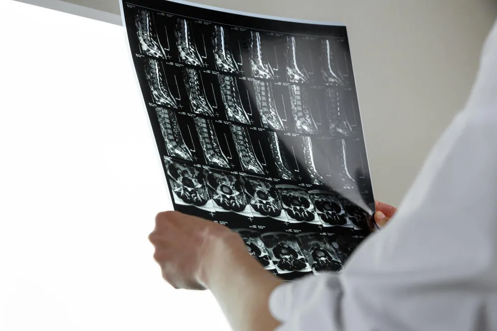 Médico analisando exame de densitometria óssea com imagens da coluna vertebral